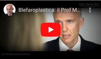 Mario Dini spiega ad una paziente l'intervento di Blefaroplastica