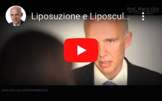 Mario Dini spiega ad una paziente l'intervento di Liposuzione